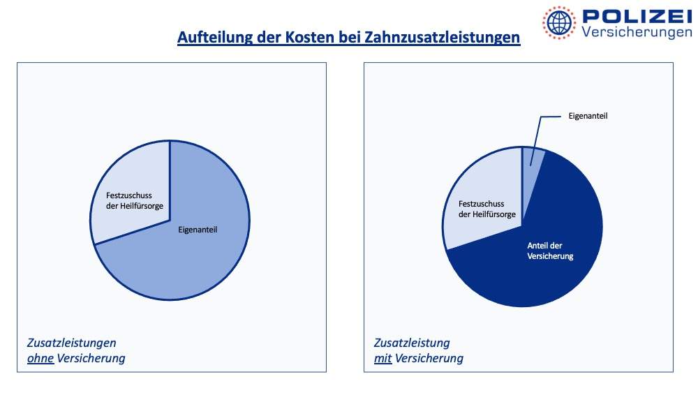 Grafik zur Aufteilung der Kosten bei Zahnzusatzleistungen mit und ohne Versicherung